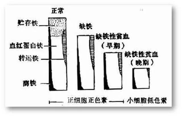 缺铁性贫血如何吃才能“补铁”?